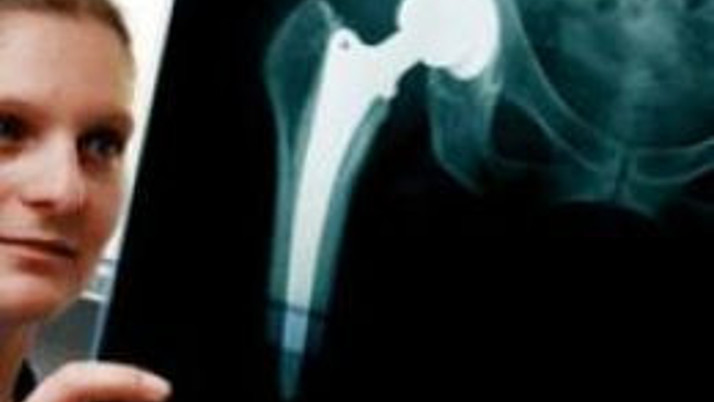 Metal kalça protezleri daha riskli